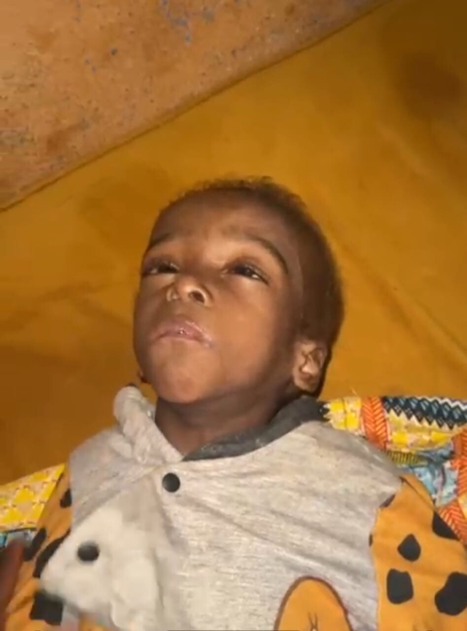 Sauvons la vie de Ryad Marez malade d'infection cérébrale 