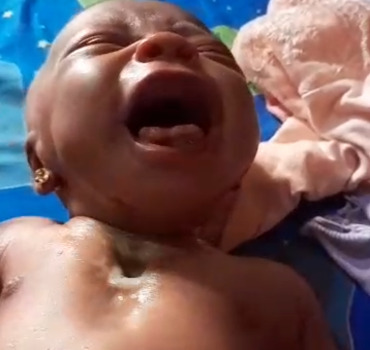 SOS  AHU basée à  Mamou RG  pour la prise  en charge  d'un  nouveau  né  deux semaines  problème  ❤️