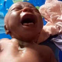 SOS  AHU basée à  Mamou RG  pour la prise  en charge  d'un  nouveau  né  deux semaines  problème  ❤️