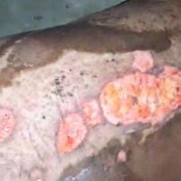 SOS  AHU basée à Mamou RG pour cette femme  brûlée  en Guinée 