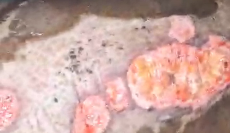 SOS  AHU basée à Mamou RG pour cette femme  brûlée  en Guinée 