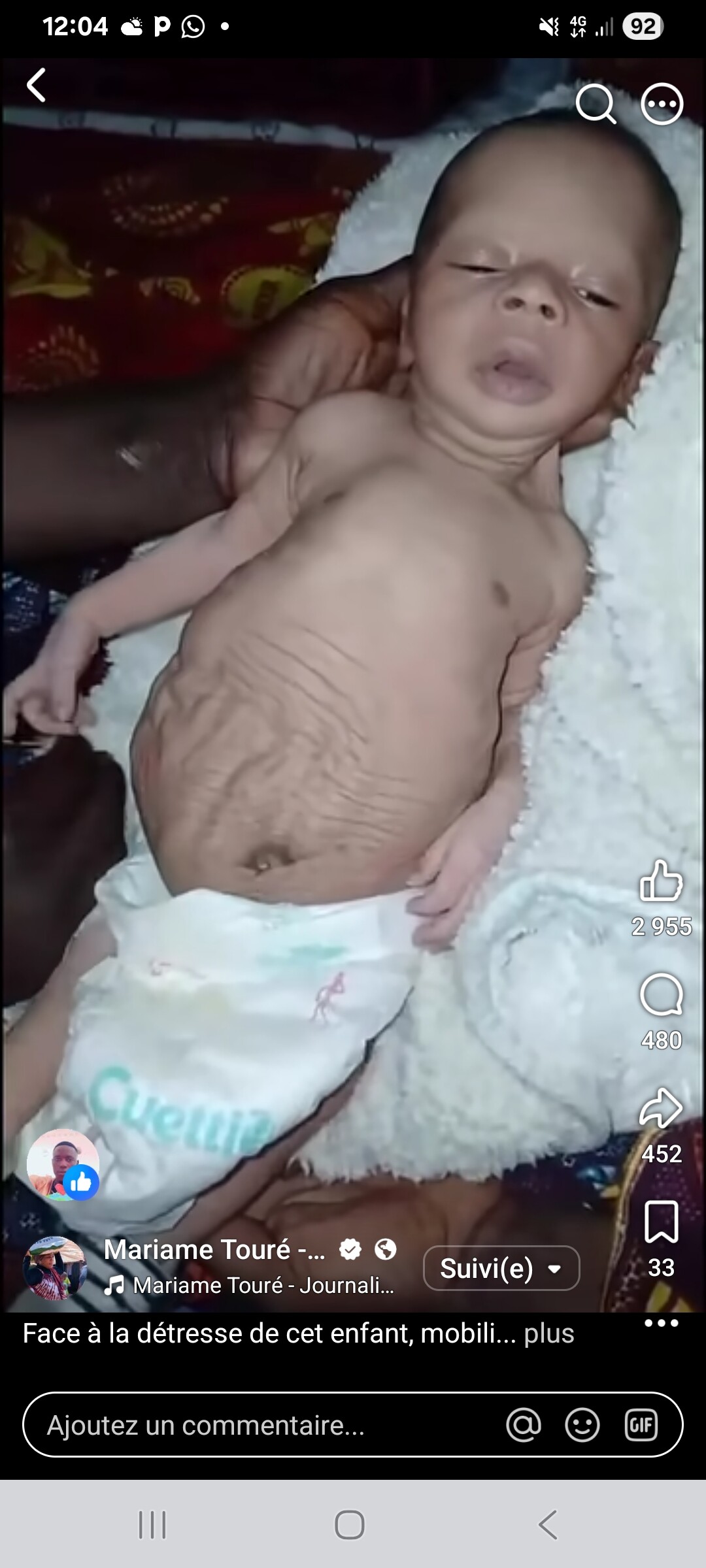 SOS AHU basée à Mamou RG pour  ce nouveau  avec une déformation 