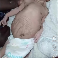 SOS AHU basée à Mamou RG pour  ce nouveau  avec une déformation 