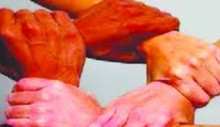 Remboursement de dette 
