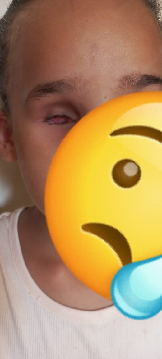 AIDONS CETTE PETITE FILLE qui a besoin de soins 