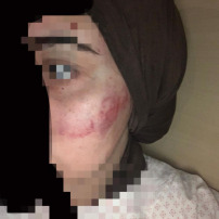 Aide relogement victime de violences conjugales