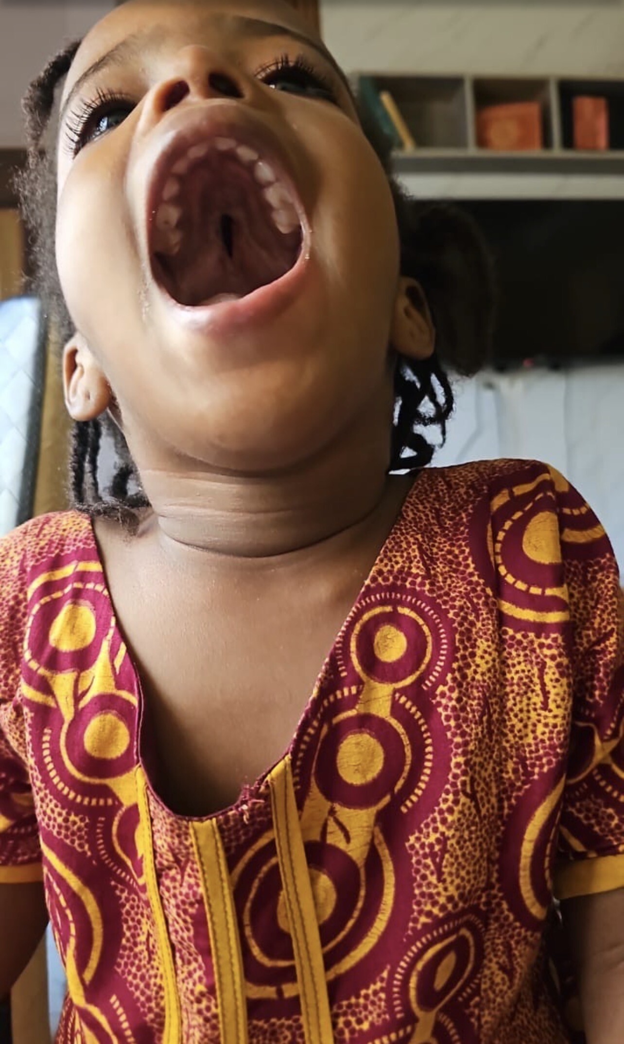 ❤️ Ensemble, offrons à une petite fille de 4 ans la chance de se faire opérer