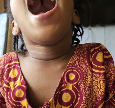 ❤️ Ensemble, offrons à une petite fille de 4 ans la chance de se faire opérer