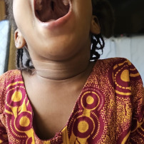 ❤️ Ensemble, offrons à une petite fille de 4 ans la chance de se faire opérer