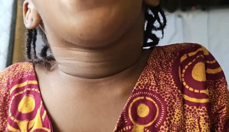 ❤️ Ensemble, offrons à une petite fille de 4 ans la chance de se faire opérer
